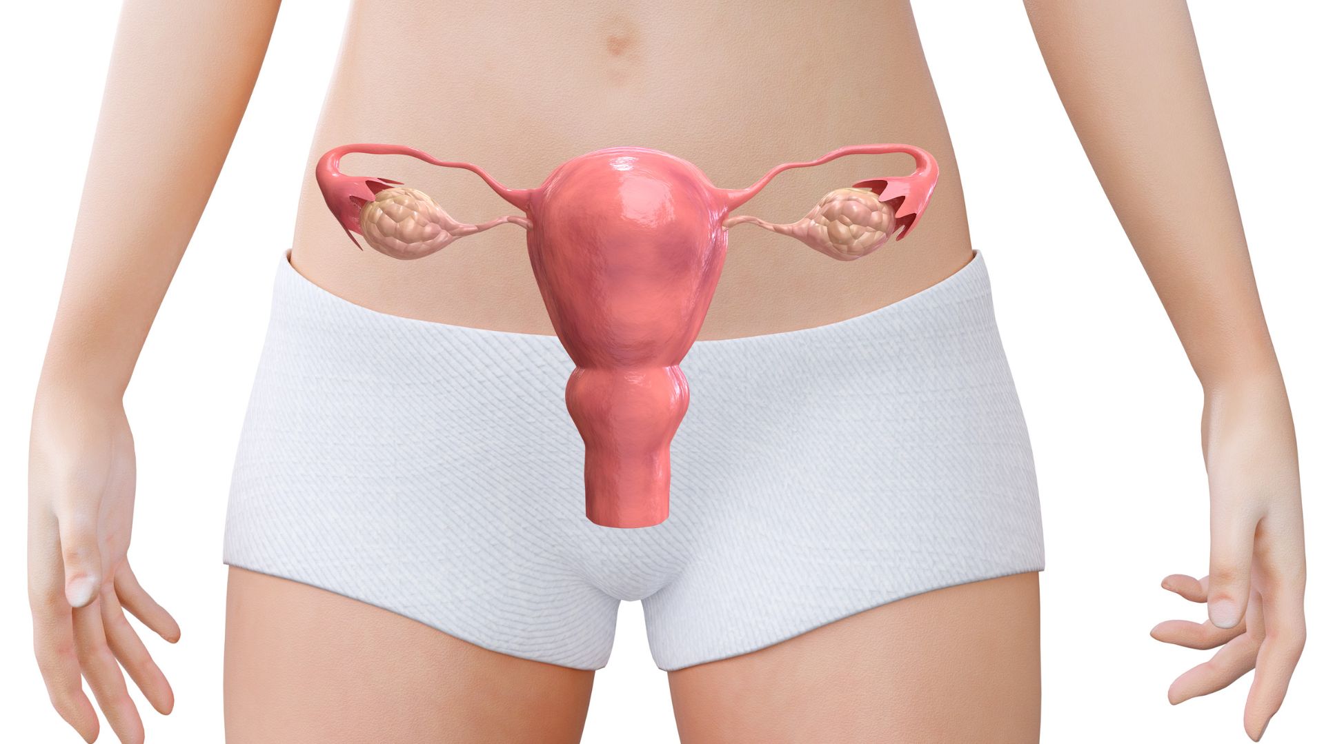 Teratoma ovariano: guia completo